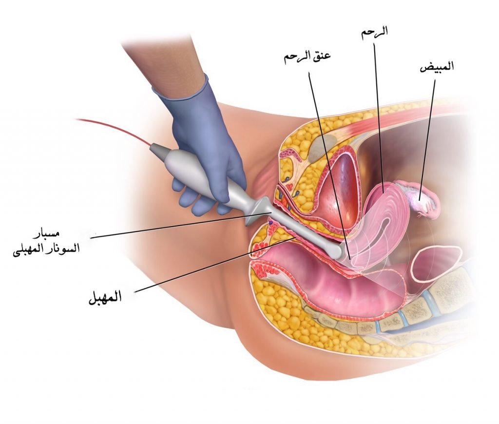 تضييق فتحة المهبل بعد الولادة