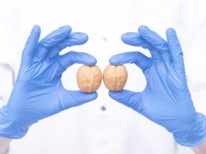 علامات دوالي الخصية