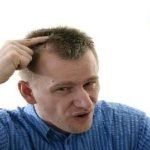 كيفية زراعة الشعر