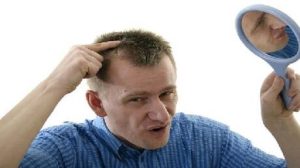 ادوية تساقط الشعر عند الرجال